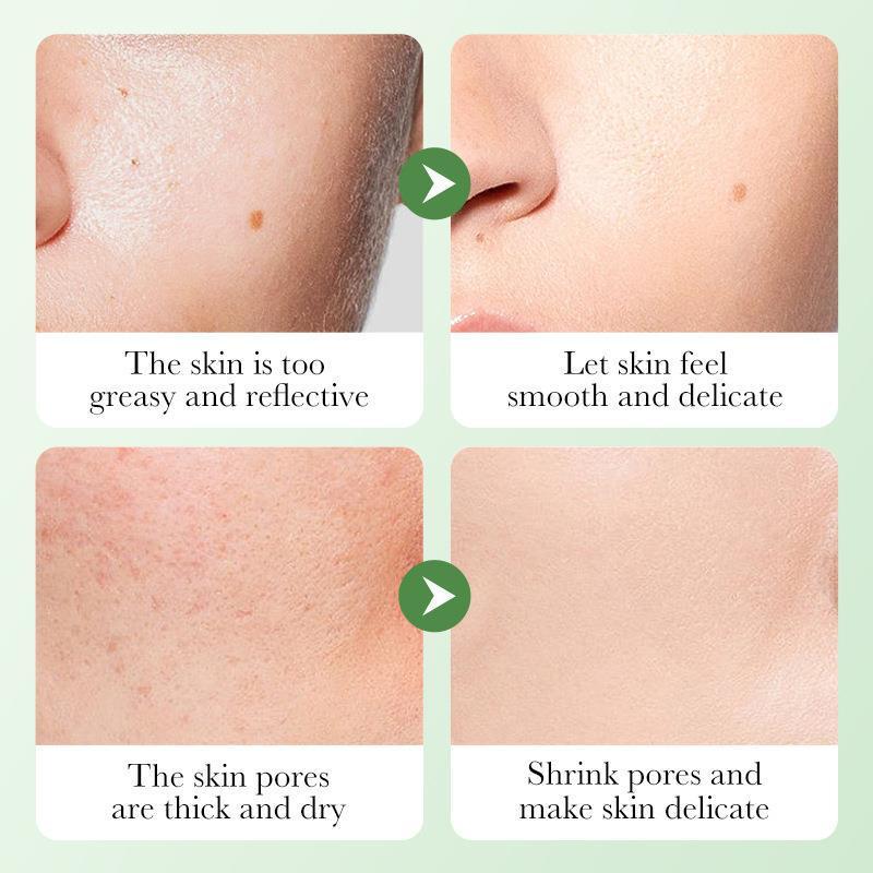 “Skin Care Set for Women – Hydrating & Moisturizing”