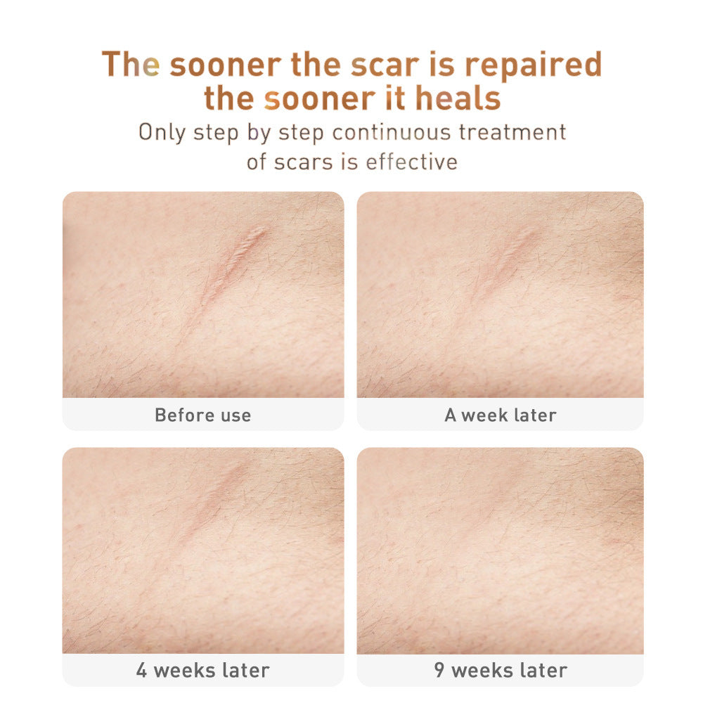 “TCM Scar Removal Cream – Skin Care & Repair”